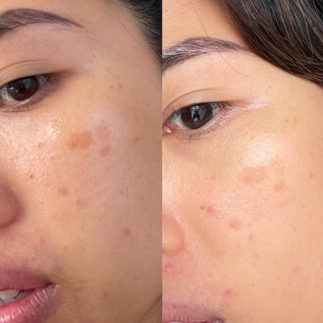 Vitamin C Booster Treatment before and after results images.