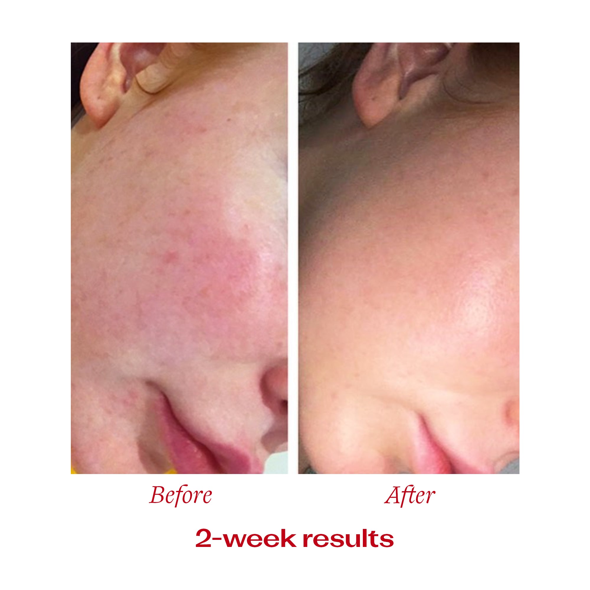 Vitamin C Booster Treatment customer before and after 2 week results picture.