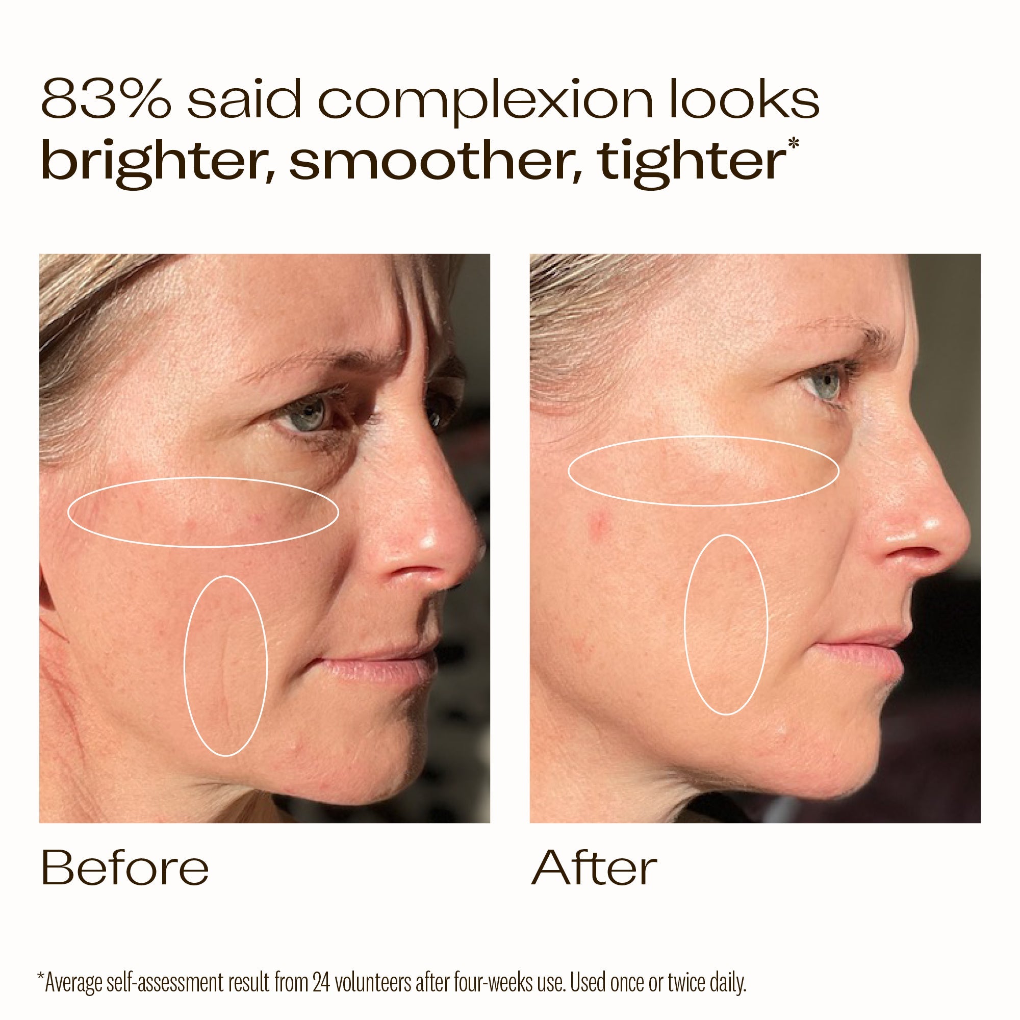 Vitamin C+ Super Serum | Before and After. 83% saif complexion looks brighter, smoother and tighter *