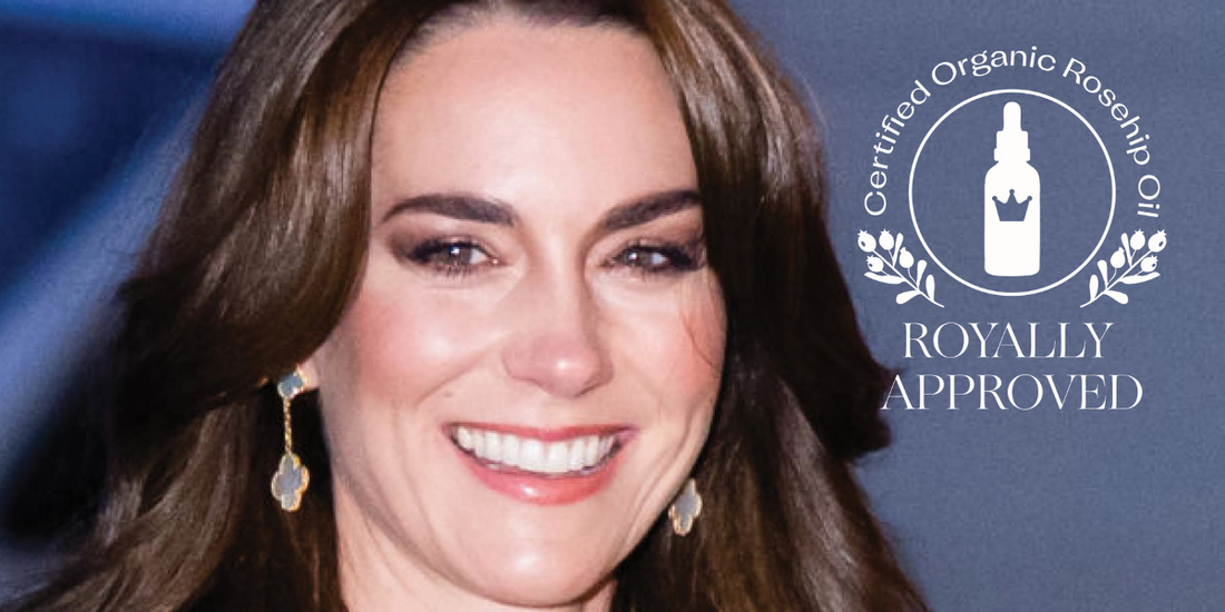 Kate Middleton’s flawless secret