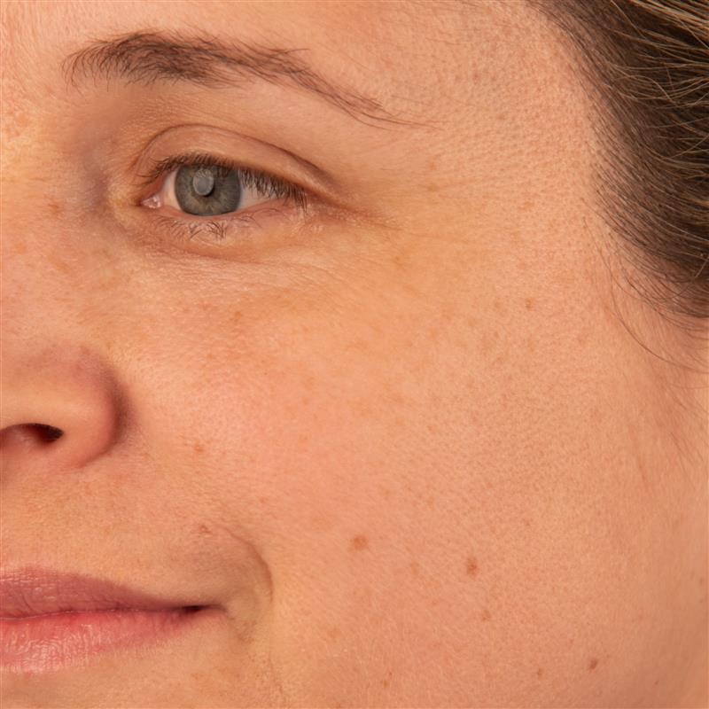 Vitamin C+ Booster serum before and after 2 weeks Trilogy AU skin brightening results