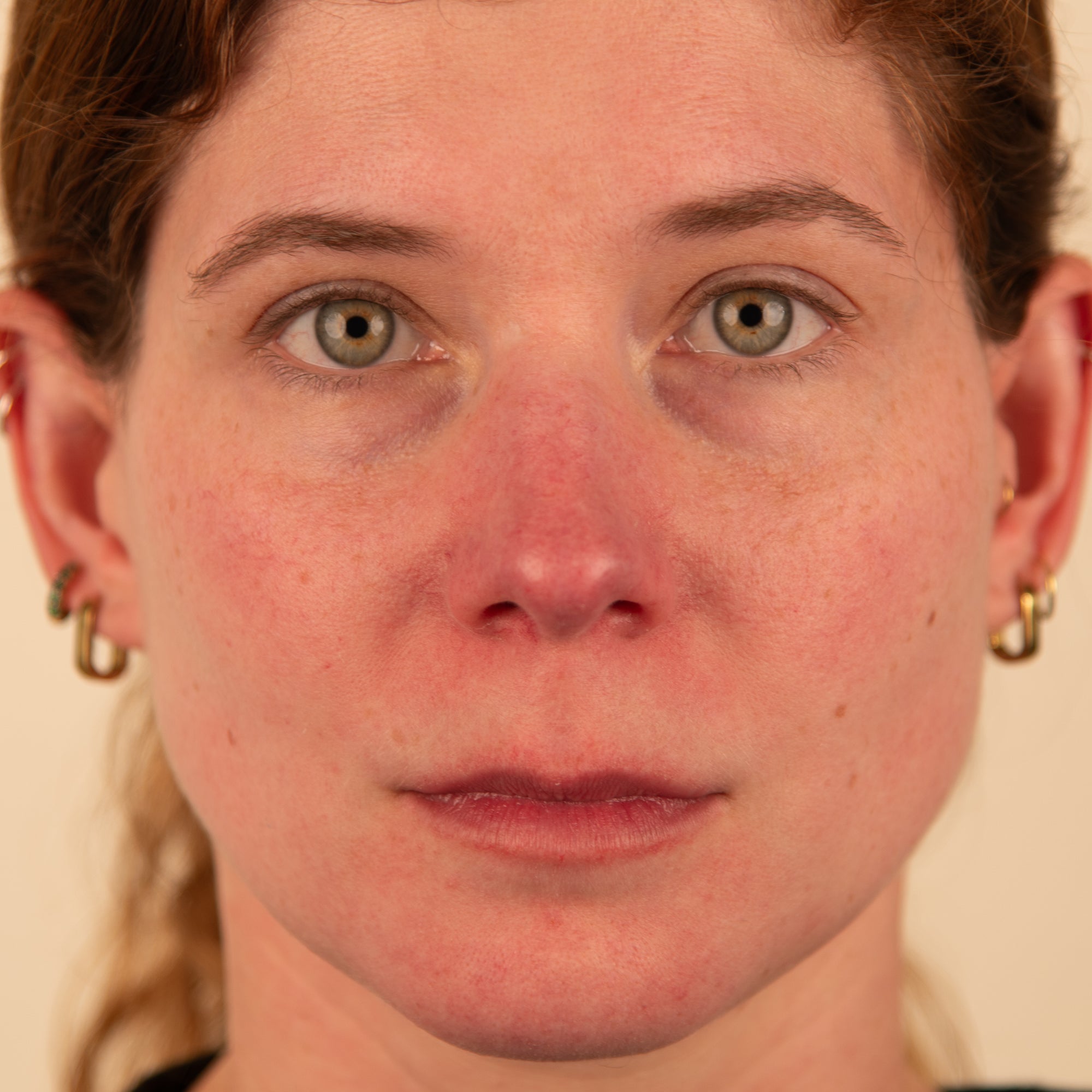 Polyglutamic+ Booster serum before and after 2 weeks Trilogy AU skin hydrating results